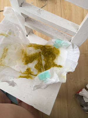 两个月宝宝昨天开始拉绿色粑粑,一股馊味,粘的,宝宝这是怎麼了,有有