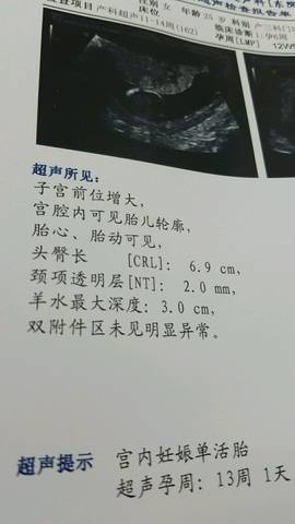 journal_insert_pic_779496825