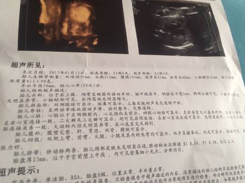 journal_insert_pic_780212345
