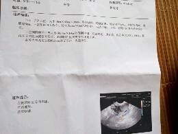 journal_insert_pic_780120482