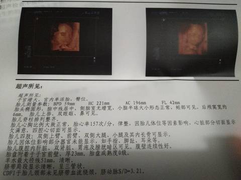 journal_insert_pic_780389901