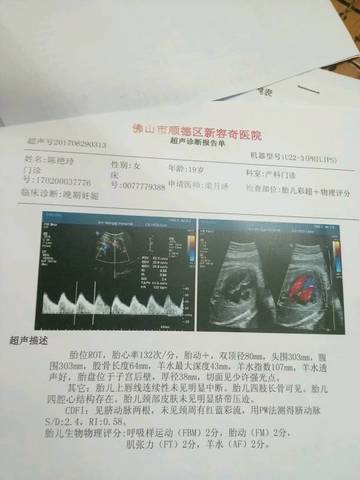 journal_insert_pic_780583370