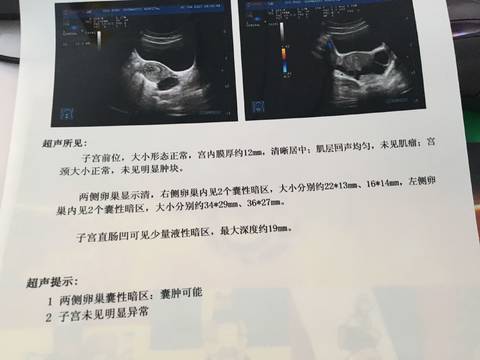 journal_insert_pic_780959719