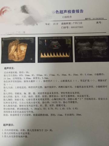 journal_insert_pic_781555660