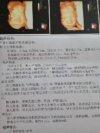 journal_insert_pic_783316482