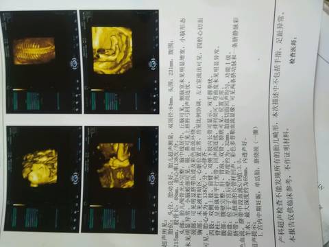journal_insert_pic_784189374