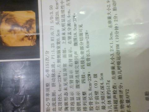journal_insert_pic_784962623
