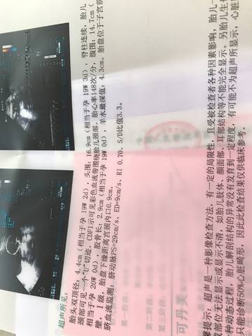 journal_insert_pic_787018396