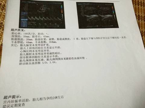 journal_insert_pic_787266447