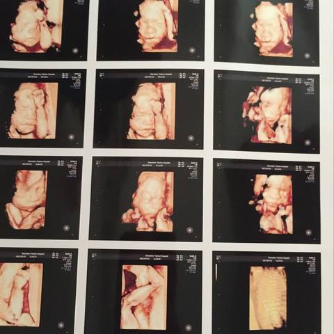 journal_insert_pic_790710113
