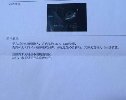 journal_insert_pic_790552855