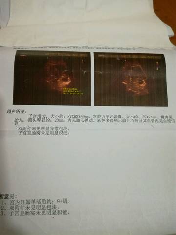 journal_insert_pic_791207379