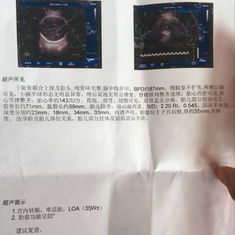 journal_insert_pic_792105128