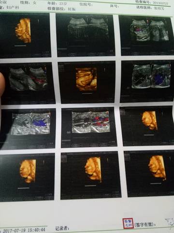 journal_insert_pic_795127278