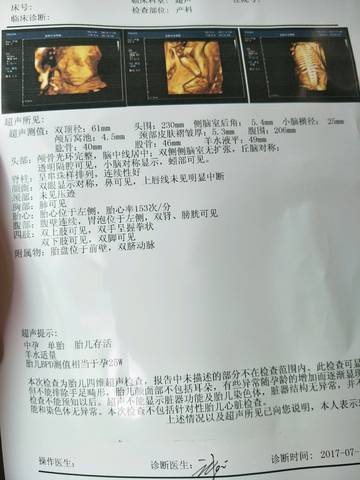 journal_insert_pic_794863392