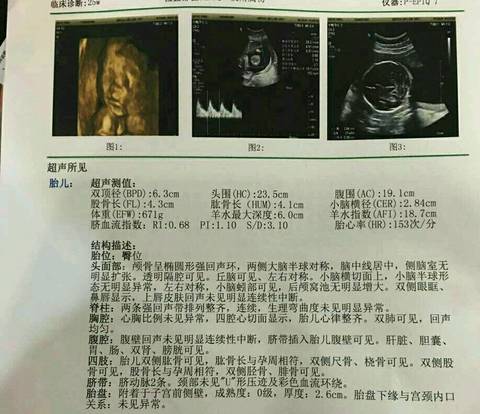 journal_insert_pic_795870935