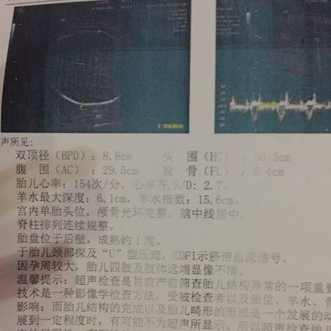 journal_insert_pic_797394244