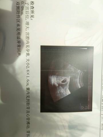 journal_insert_pic_797876391