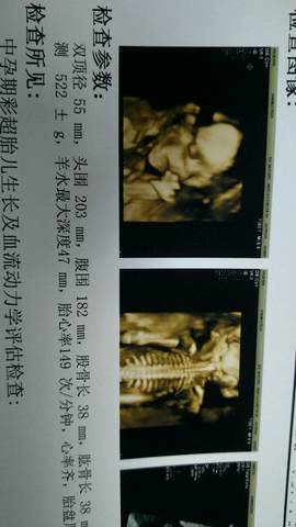 journal_insert_pic_798560007