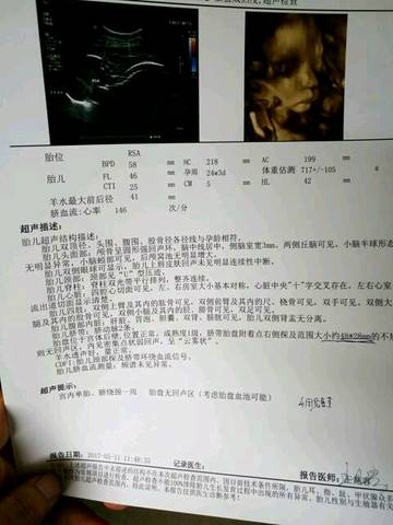 journal_insert_pic_801241206