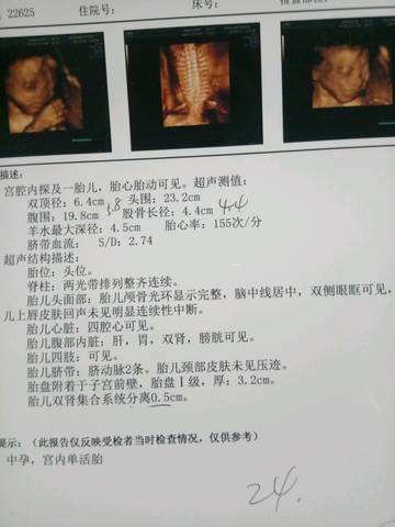 journal_insert_pic_804547389