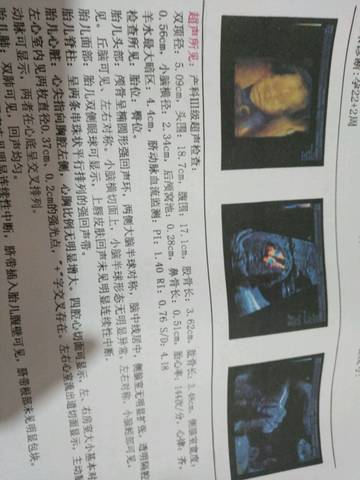 journal_insert_pic_805476229
