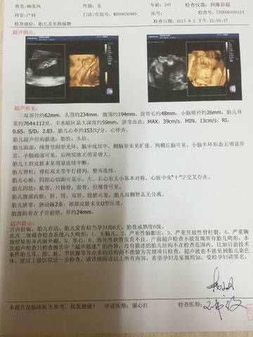 journal_insert_pic_805807166