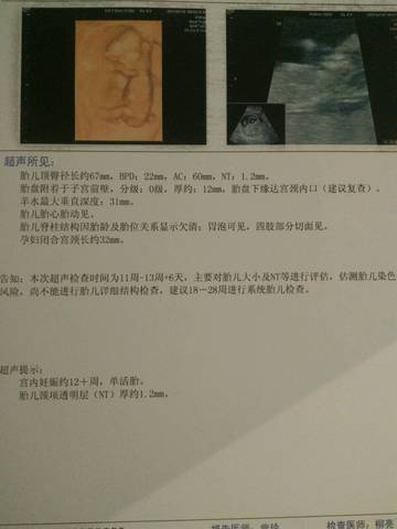 journal_insert_pic_806536221