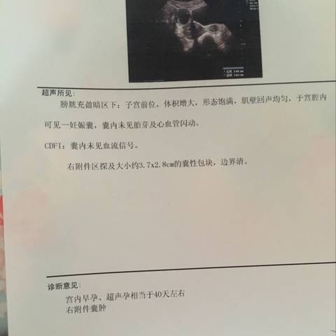 journal_insert_pic_806769673