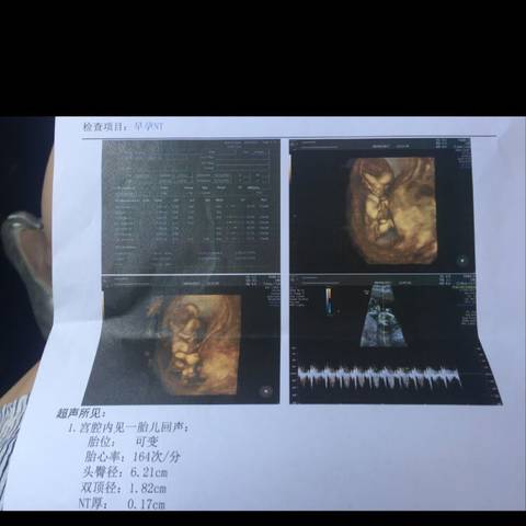 journal_insert_pic_807354775