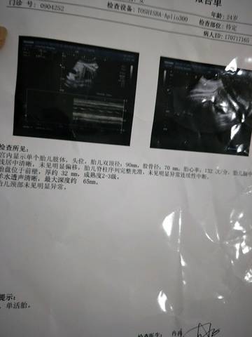 journal_insert_pic_808381905