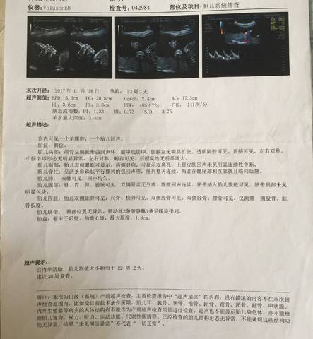 journal_insert_pic_809608673