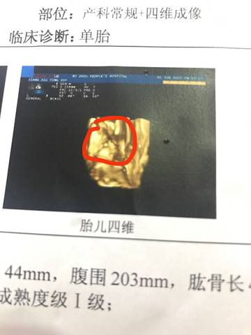 journal_insert_pic_809391369