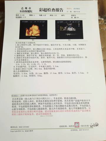 journal_insert_pic_810616517