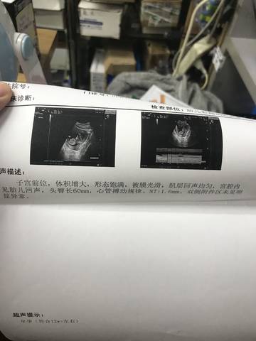 journal_insert_pic_811206442