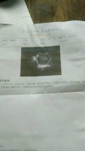 journal_insert_pic_813384645