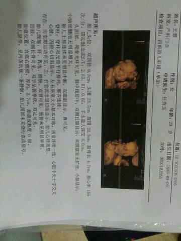 journal_insert_pic_814714723