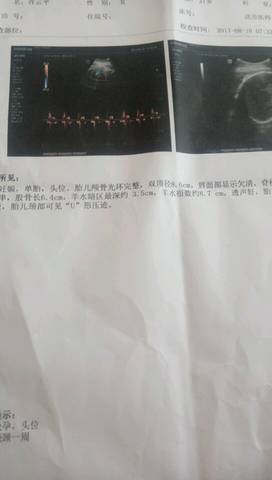 journal_insert_pic_817727397