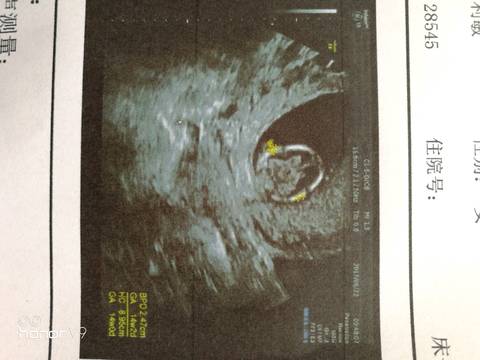 journal_insert_pic_820908988