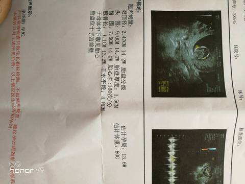 journal_insert_pic_820909006