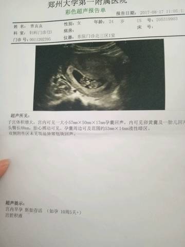 journal_insert_pic_821010878