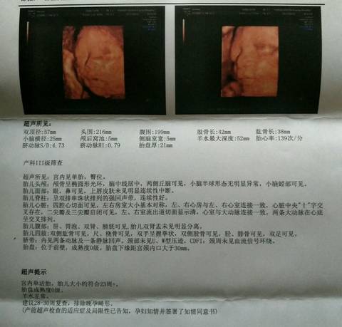 journal_insert_pic_822046086