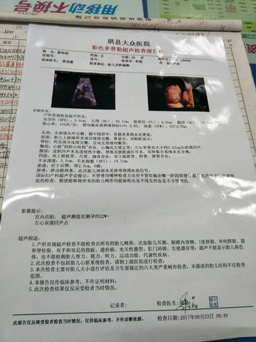 journal_insert_pic_821998589