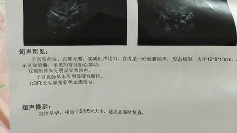 journal_insert_pic_822886326