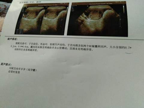 journal_insert_pic_824430468
