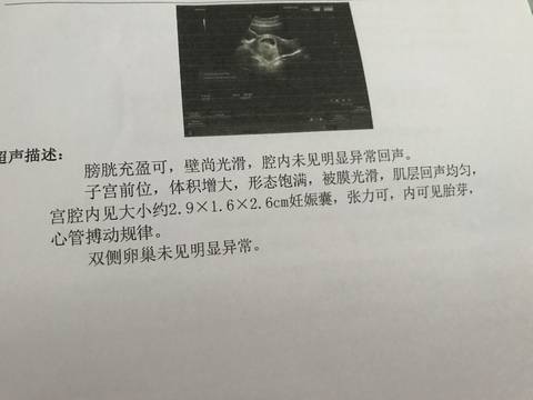 journal_insert_pic_825017649