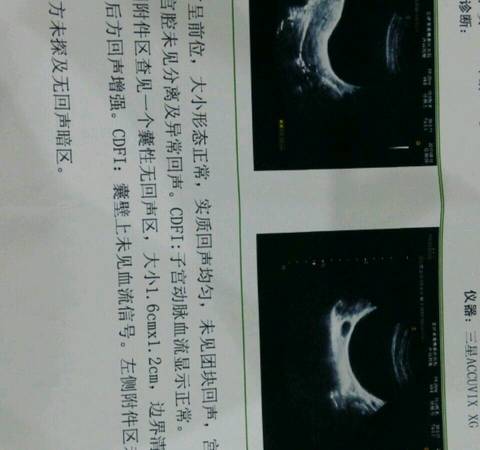journal_insert_pic_827305314