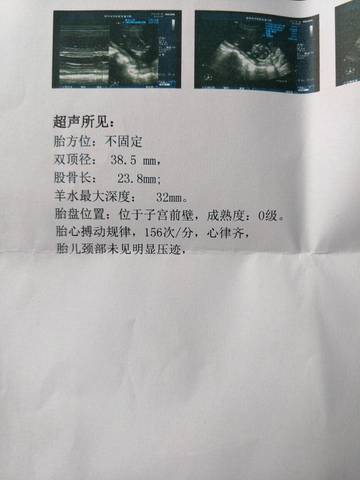 journal_insert_pic_827854708