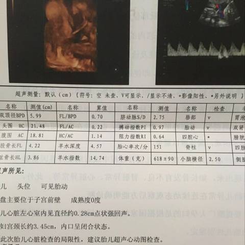 journal_insert_pic_828659707