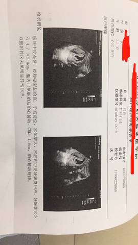 journal_insert_pic_829999295